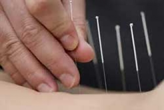 STJ proíbe o tratamento com acupuntura por psicólogos
